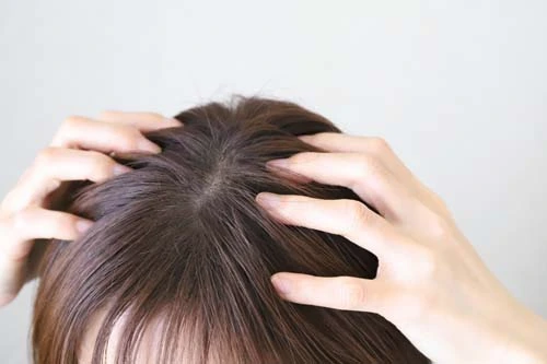 アトピー素因が円形脱毛症に関与
